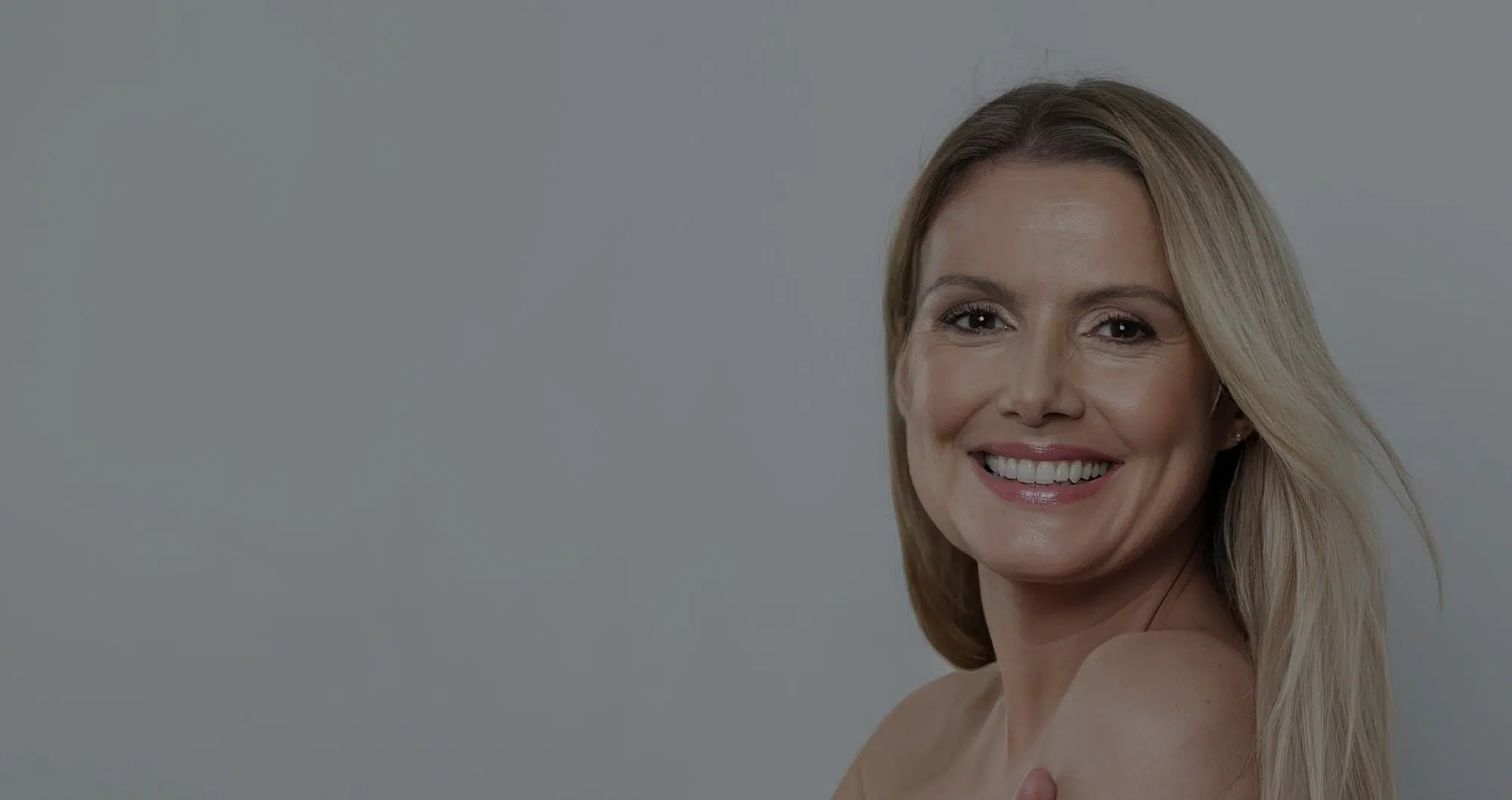 Deep Plane Facelift Result